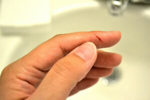 Giải mã ý nghĩa giấc mơ thấy bị đứt tay thấy chảy máu 1 mơ thấy đứt tay chảy máu