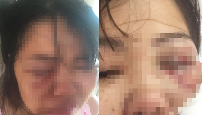Mơ thấy mình đánh vợ Mơ thấy mình đánh vợ